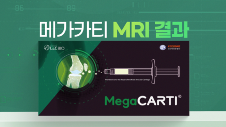 240401_Megacarti_썸네일_메가카티 효과.png